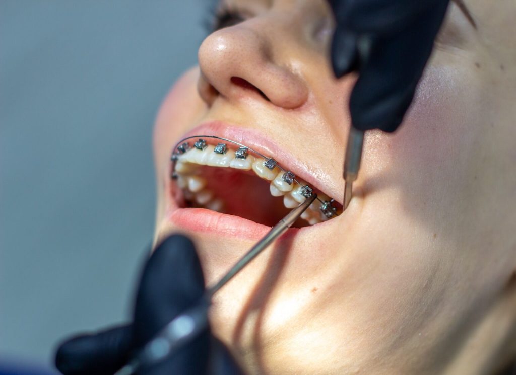 Ocean Dental and Aesthetics in Hilton Head Island, SC